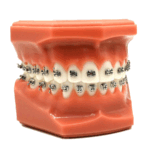 تایپودونت (مدل دندان)