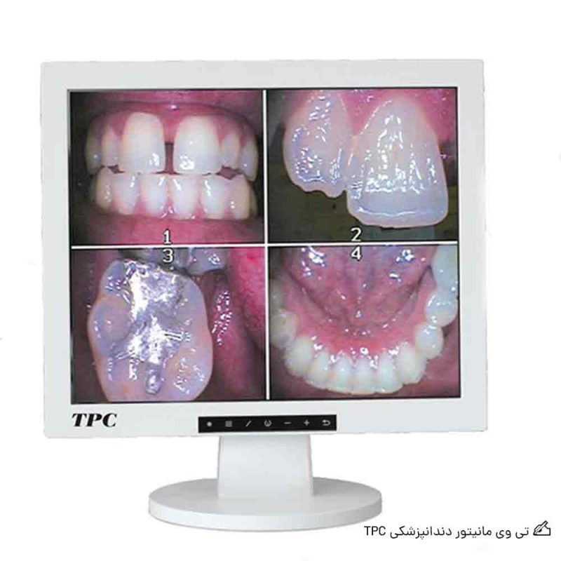 تی-وی-مانیتور-دندانپزشکی-TPC