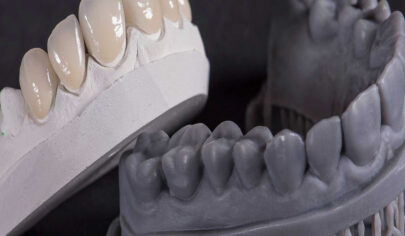 چاپ‌گرهای سه بعدی در دندان پزشکی