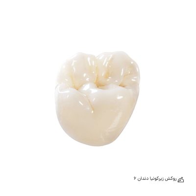 روکش زیرکونیا دندان 6