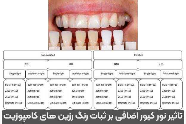 نمونه رنگ کامپوزیت دندان
