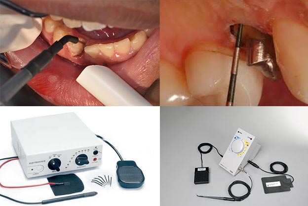 دستگاه الکتروسرجری دندانپزشکی